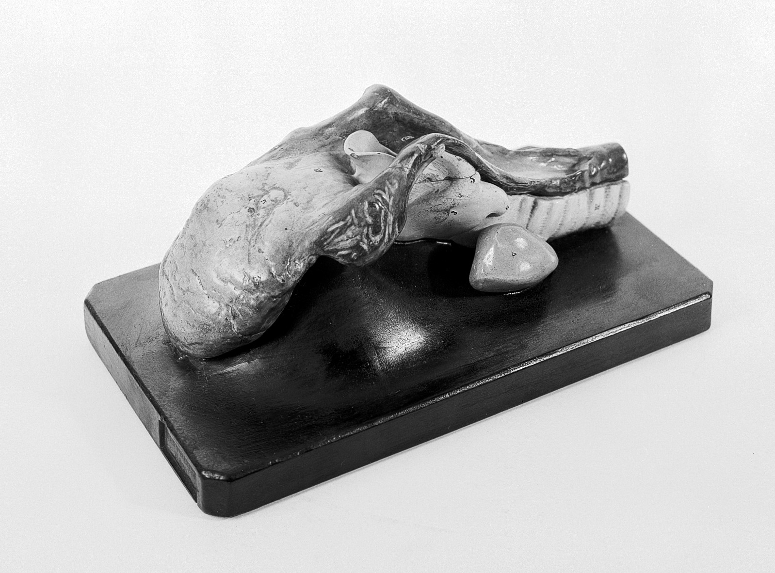 Anatomical model of human tongue, made of China, on plaster base. European, for hanging
Wellcome Collection